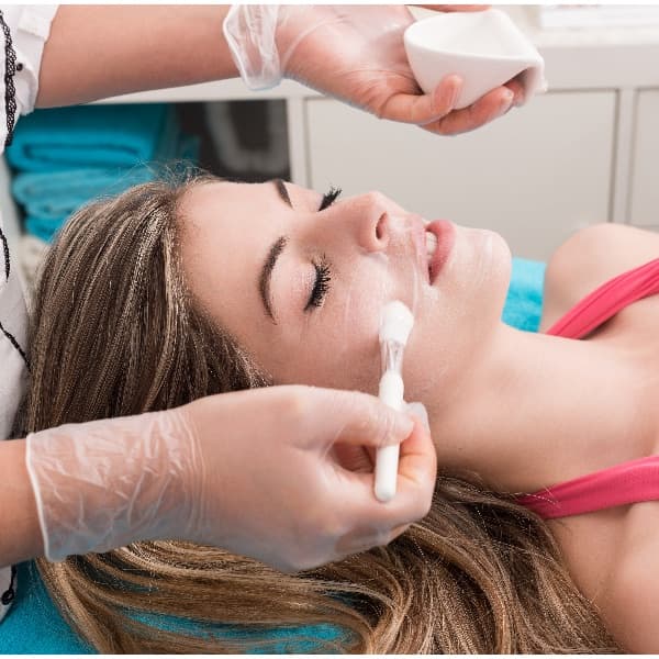 Chemical peel treatment