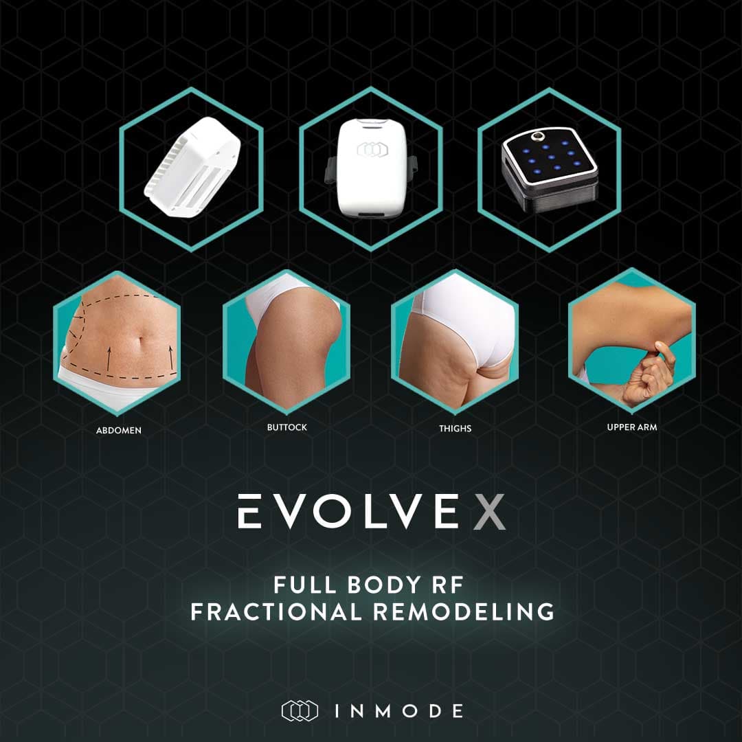 EvolveX by InMode