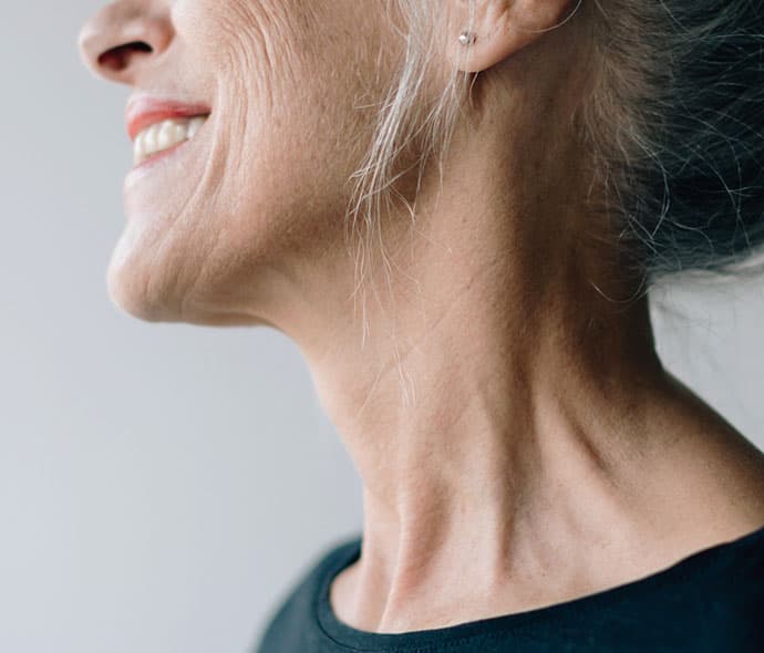 SkinPen microneedling treatment — 3